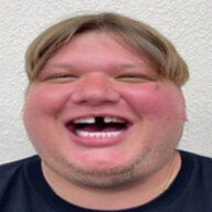 frexo